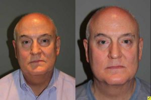 Blepharoplasty and cosmetic surgery silo before and after - 52 year old male 3 months post op from upper and lower blepharoplasty or eyelid lift.