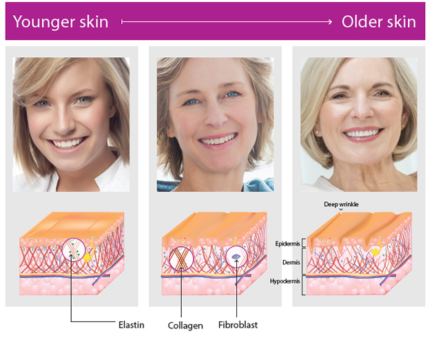 Graphic showing the difference of elastin, collagen and fibroblast in young and old skin