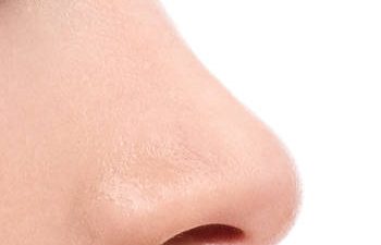 Closeup of a Nose After Rhinoplasty Atlanta GA