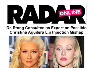 Radar Online headline with two side-by-side photos of Christina Aguilera; one shows her smiling, the other with less expression. Text discusses a possible lip injection mishap.