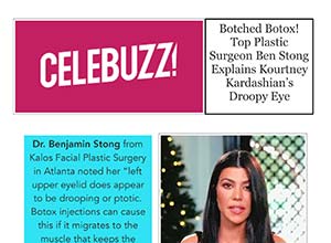 Screenshot of an article discussing Kourtney Kardashian’s droopy eye, linking it to Botox, with a photo of Kourtney Kardashian and text from a plastic surgeon.