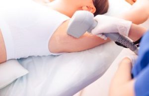 Woman undergoing laser underarm hair removal.