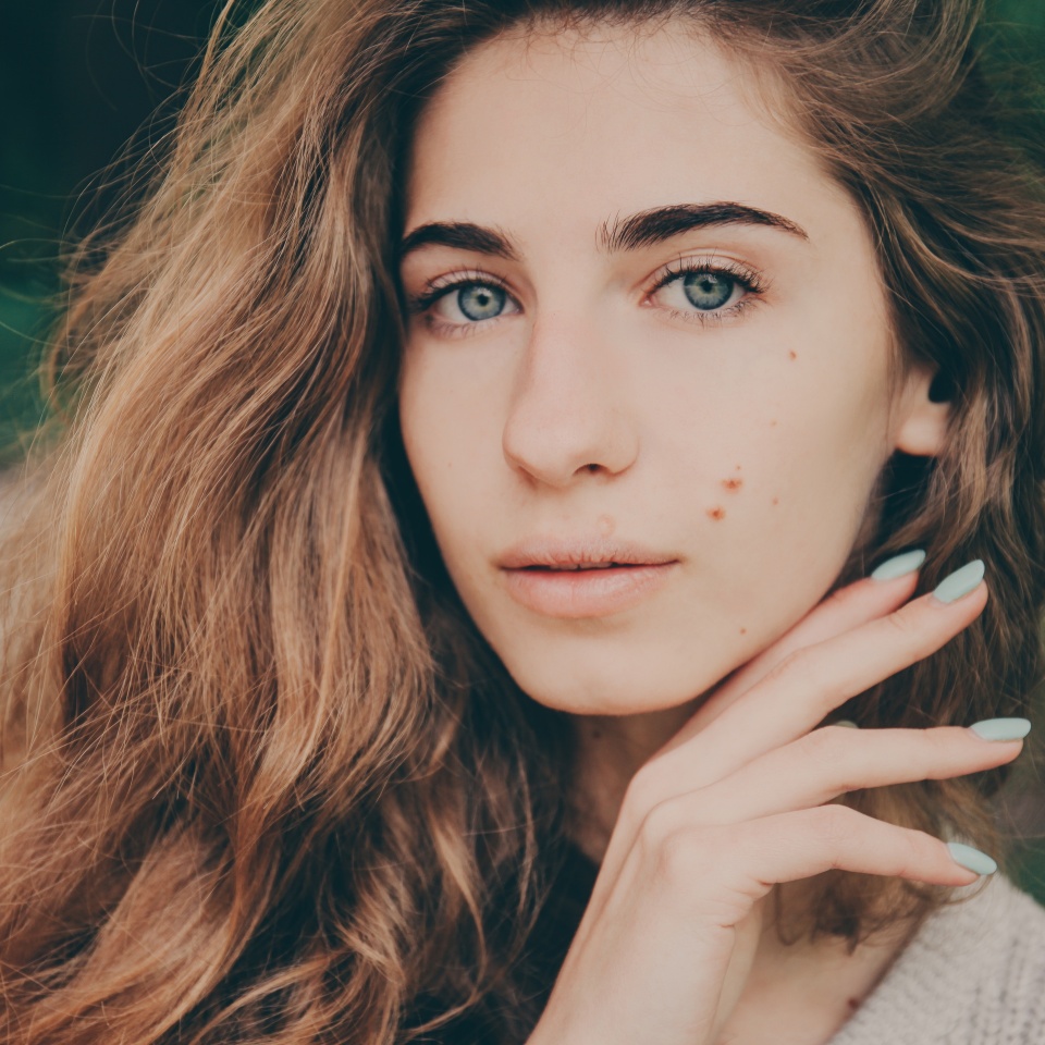 Portrait of a beautiful authentic curly-haired girl in the park in a light beige sweater with blue eyes and birthmarks on her face. No makeup.