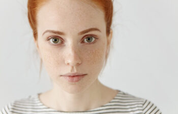 A young woman with fair skin, red hair, and freckles looks directly at the camera, wearing a white and black striped shirt against a plain light background.