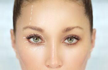 Eyelid Surgery.Brow Lift.upper eyelids.Forehead lift.Marking the face.Perforation lines on females face, plastic surgery concept.