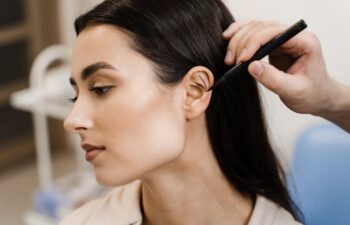 Otoplasty mark-up for surgical reshaping of pinna and ear. Otoplasty markup before ear surgery. Surgeon draw marking on ear before otoplasty cosmetic surgery