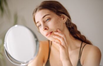 Young woman with problem skin looking into mirror. Concept of acne therapy, scars, inflammation on face, problem skin. Beauty care.