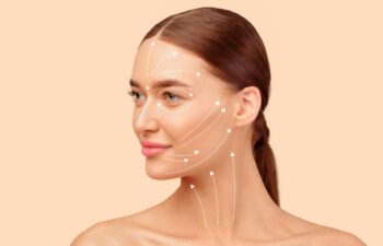 Facelift Routine. Portrait Of Young European Lady With Lifting Arrows Lines On Face Over Beige Studio Background, Looking Aside. Effortless Facial Skincare And Anti Aging Renewal Treatment Concept