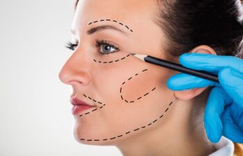 Close-up Of A Surgeon Correction Drawing Lines On Young Woman Face For Plastic Surgery