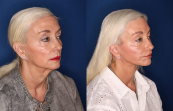 Side-by-side photos of an older woman with long white hair, showing different makeup, outfits, and slight changes in facial appearance against a blue background.